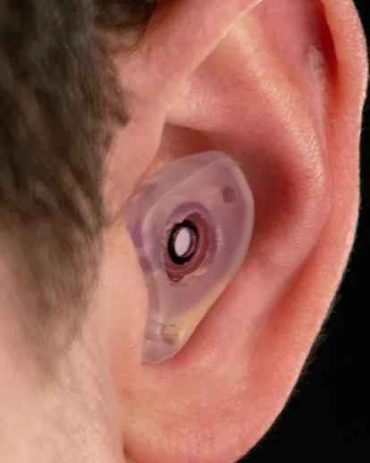 Custom filtered earplug worn and sealed in the ear